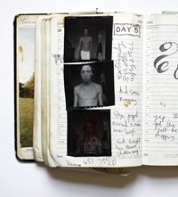 5. Nigel Shafran, chicken pox self portrait diary 