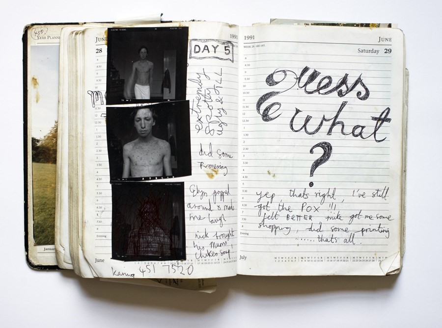5. Nigel Shafran, chicken pox self portrait diary 