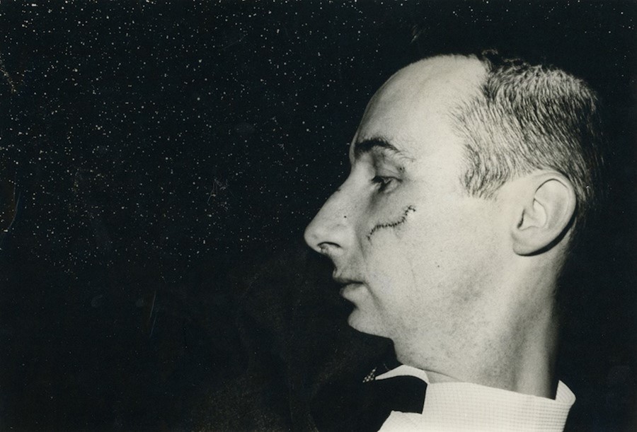 24 Marcia Resnick (photographer), Portrait of Vict